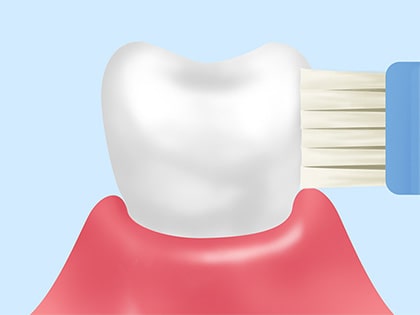 ブラッシング指導～毎日のケアがあなたを守る