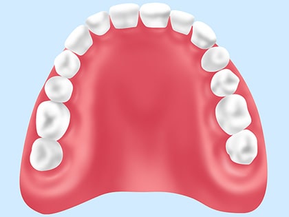 保険適用の入れ歯
